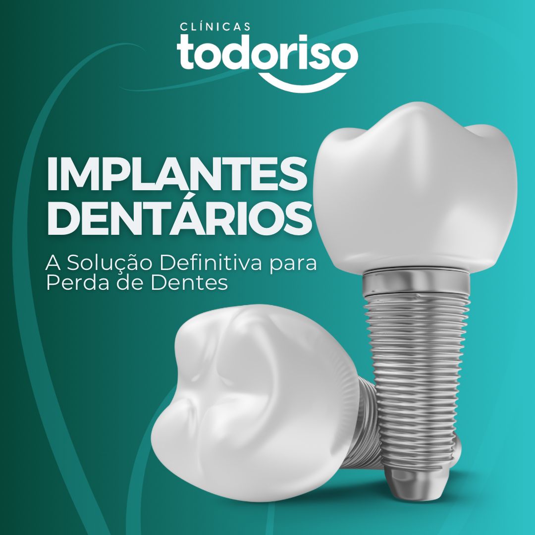 Prótese protocolo sobre implantes na Clínica Todoriso