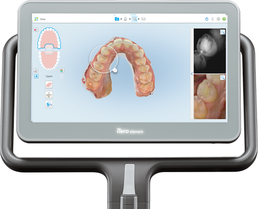 Scanner intraoral iTero 5D para odontologia digital